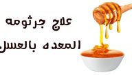 فوائد العسل لجرثومة المعدة