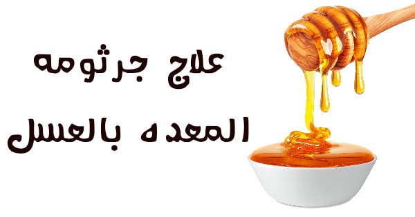 فوائد العسل لجرثومة المعدة