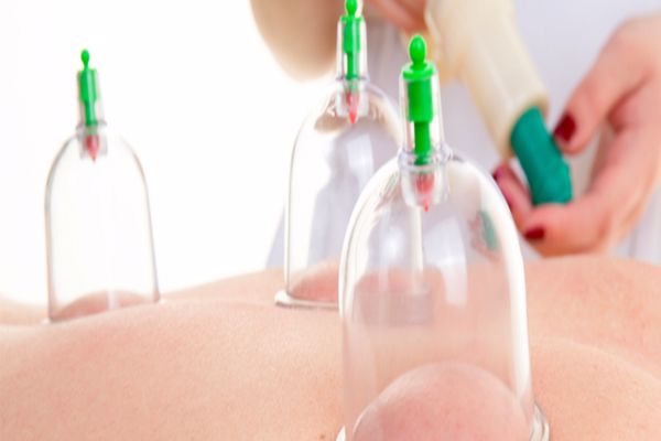 فوائد الحجامة للنساء فوائد الحجامة للنساء