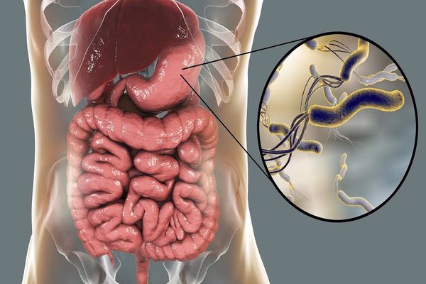 فيتامين B12 وجرثومة المعدة