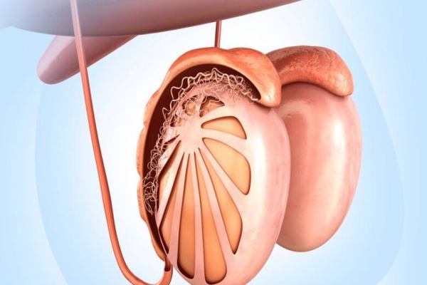 علاج دوالي الخصية طبيعيا