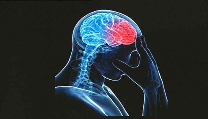 ما سبب التهاب اعصاب الدماغ ما سبب التهاب اعصاب الدماغ