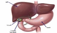 ما هي مخاطر استئصال المرارة