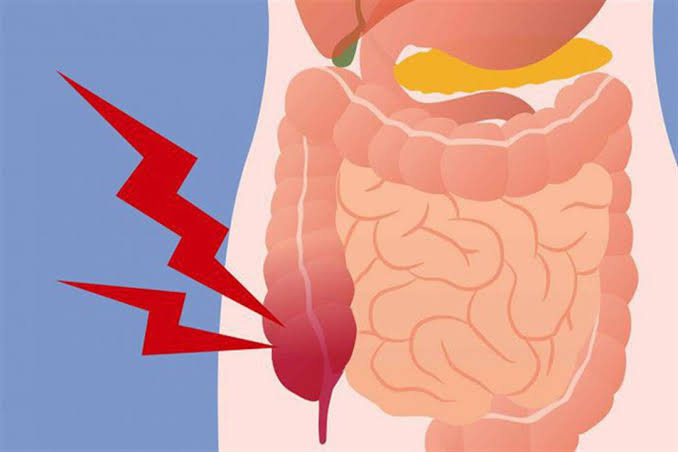 أين يكون ألم القولون العصبي