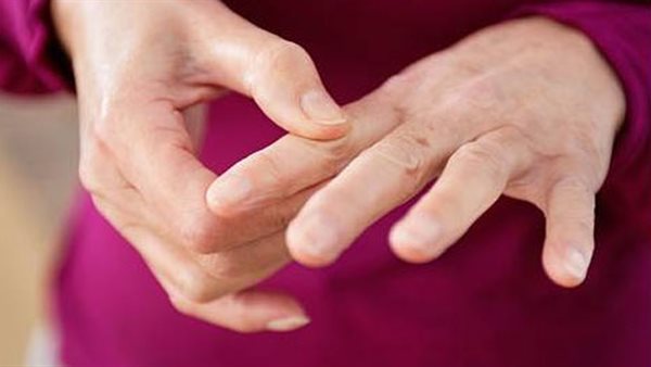 أعراض الروماتويد المبكرة أعراض الروماتويد المبكرة