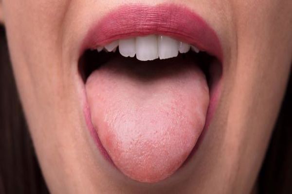 أسباب تنميل اللسان وعلاجه