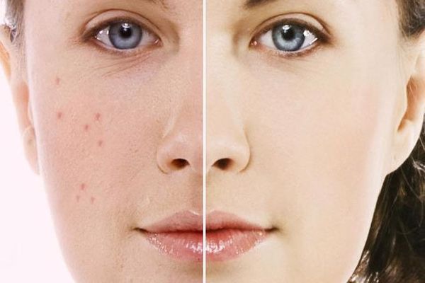 أسباب تصبغات الجلد