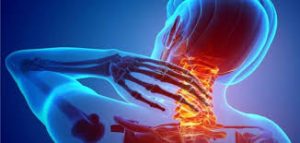 اسم دواء لعلاج غضروف الرقبة