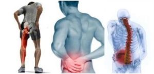 علاج عرق النسا عند الرجال