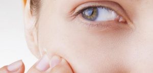 مدة علاج هرمون الذكورة عند النساء