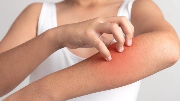 أفضل الوصفات الطبيعية لعلاج الحكة الجلدية