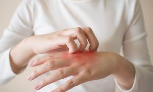 أفضل الوصفات الطبيعية لعلاج الحكة الجلدية