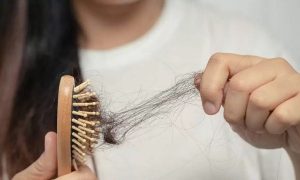 ما هو أفضل علاج لتكثيف الشعر ومنع التساقط؟