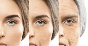 ما هي أسرع وصفة لشد تجاعيد الوجه؟