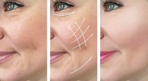 وصفات طبيعية لتقليل التجاعيد المبكرة باستخدام مكونات منزلية