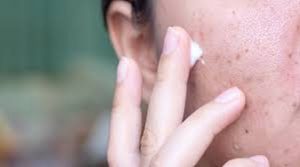 كيف أجعل حبة تختفي بسرعة؟