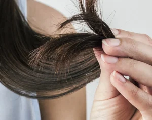 علاج الشعر الجاف والمتقصف في المنزل